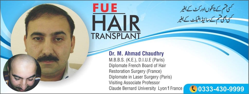 Celebrity hair transplant Pakistan