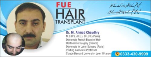 Read more about the article Celebrity hair transplant Pakistan