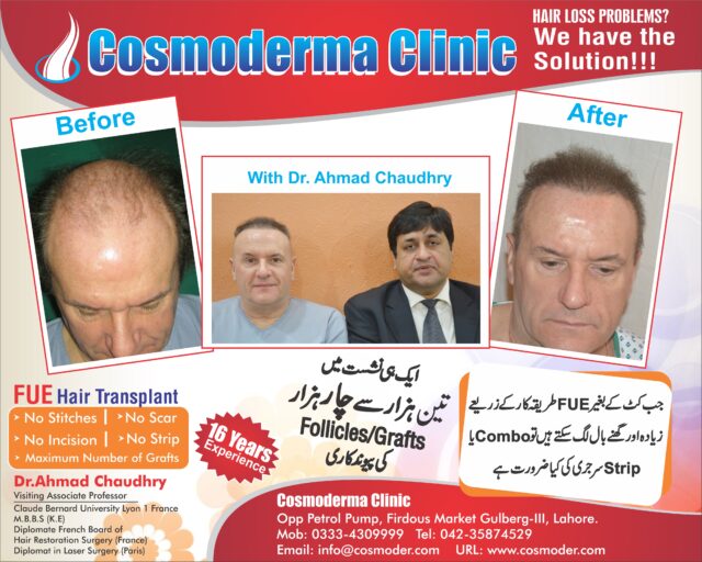 fue hair transplant