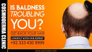 Read more about the article How to prevent hair loss
