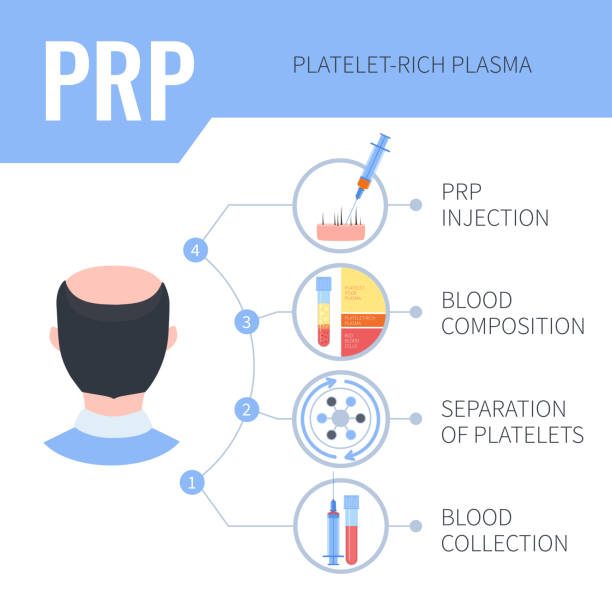 Platelet rich plasma steps