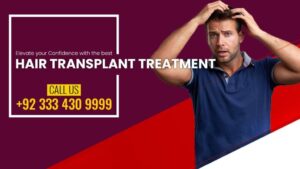 Read more about the article Best place to get a hair transplant