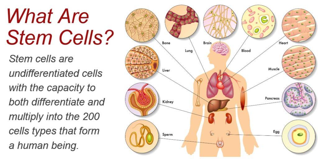 Stem Cell-treatment-Lahore- Pakistan