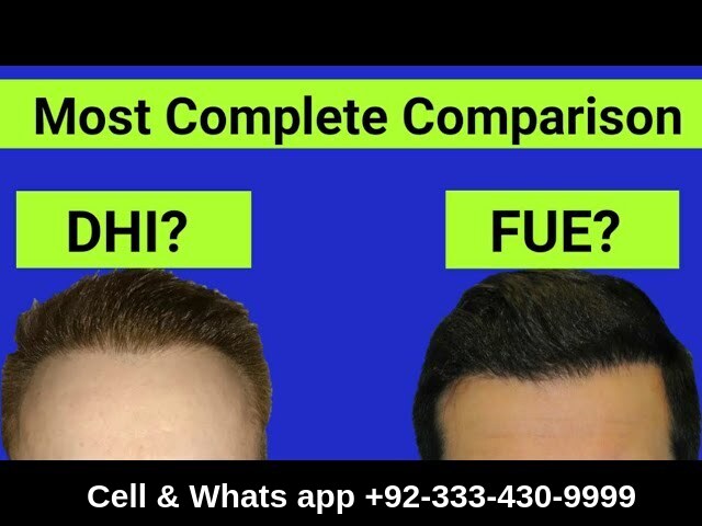 Read more about the article DHI VS FUE technique