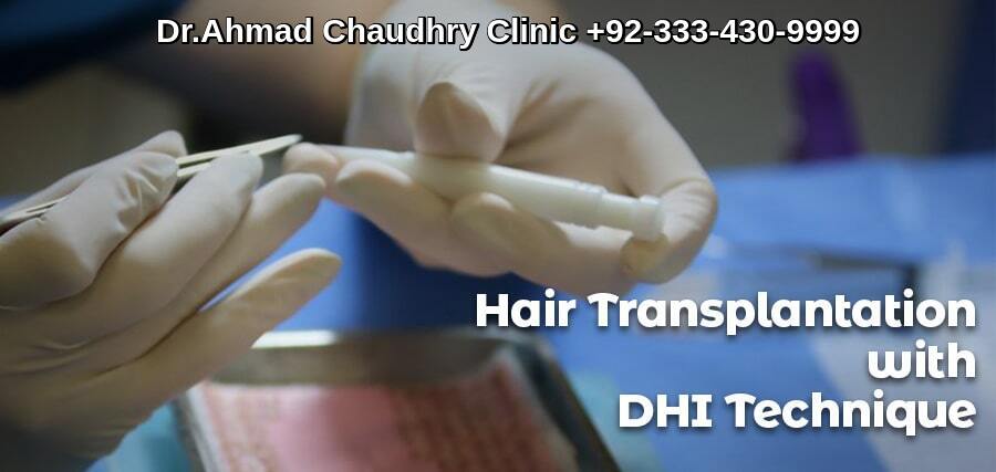 DHI hair transplant Pakistan