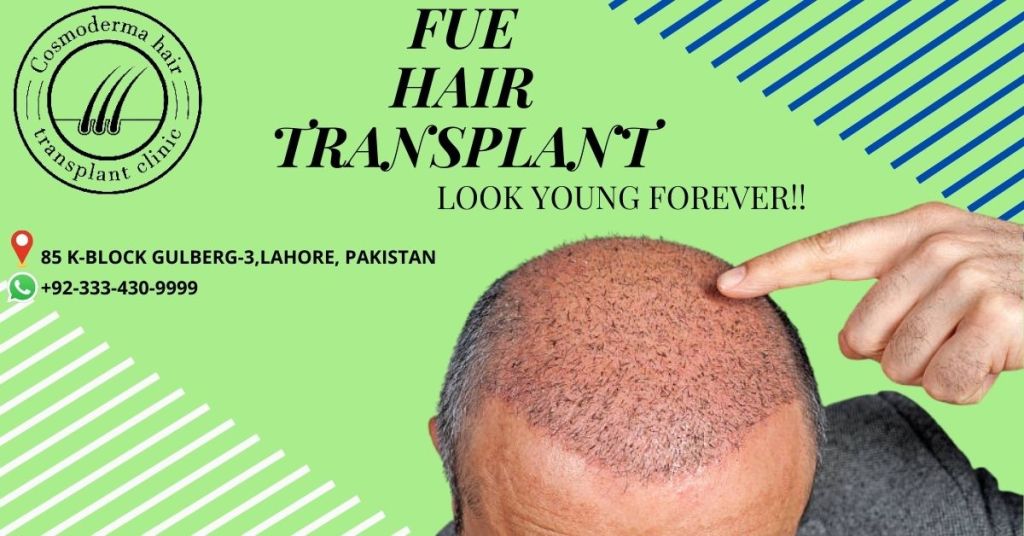 4000 grafts hair transplant cost