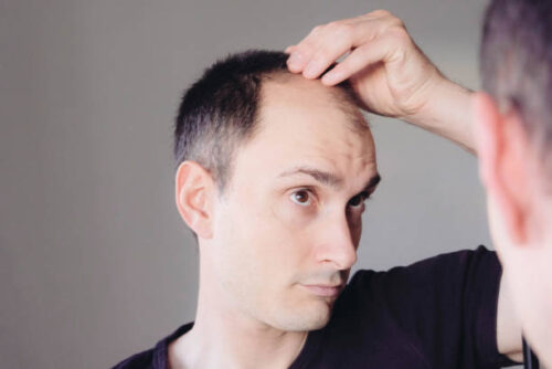 Read more about the article Can we treat baldness