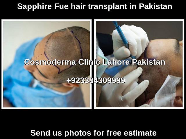 Best Fue clinic Pakistan