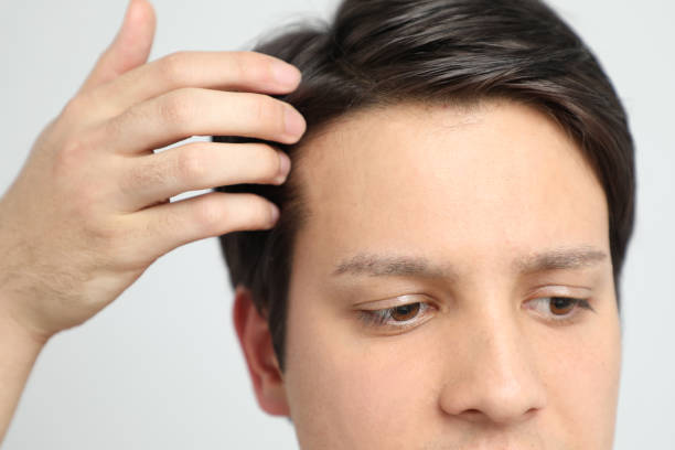 Hair transplant surgery young patient