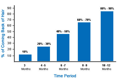 hair-transplant-growth-timeline