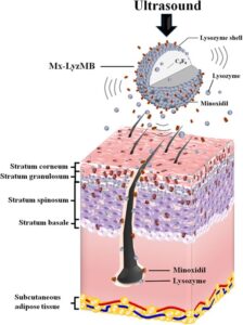 Minoxidil coated lysozyme Pakistan